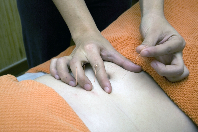 osteopathe-VILLARS SUR VAR-min_acupuncture-4175625